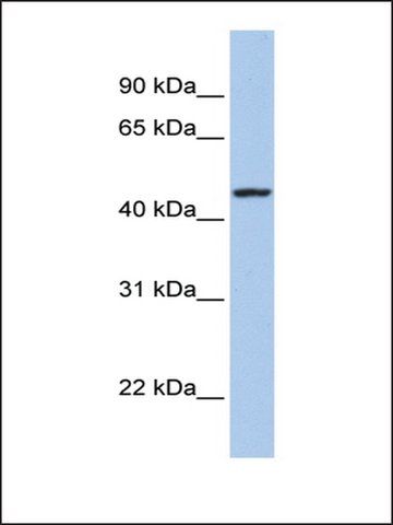 Anti-ROM1 antibody produced in rabbit