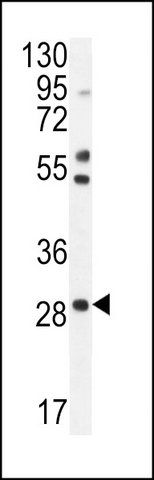 ANTI-RNF183 (CENTER) antibody produced in rabbit