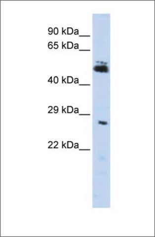 Anti-RNF212 antibody produced in rabbit