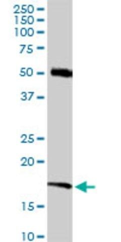 Anti-RNF181 antibody produced in rabbit