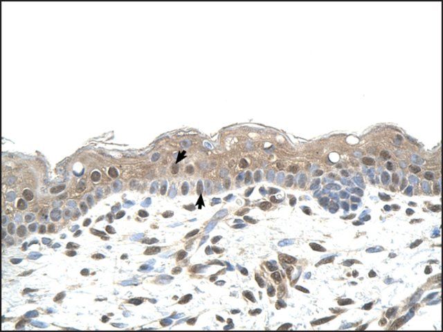 Anti-RNF25 antibody produced in rabbit