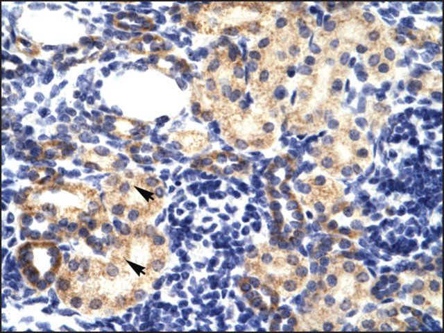 Anti-RNF2 (AB2) antibody produced in rabbit