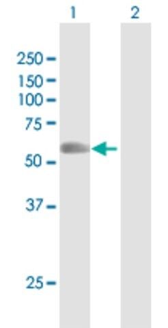 Anti-RNF8 antibody produced in rabbit