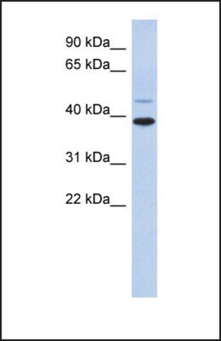 Anti-RNF121 antibody produced in rabbit