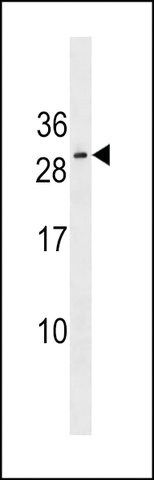 ANTI-RNF223 (CENTER) antibody produced in rabbit