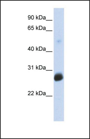 Anti-RNF186 antibody produced in rabbit