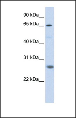 Anti-RNF186, (N-terminal) antibody produced in rabbit