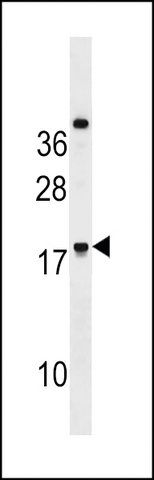 ANTI-RNF224 (CENTER) antibody produced in rabbit