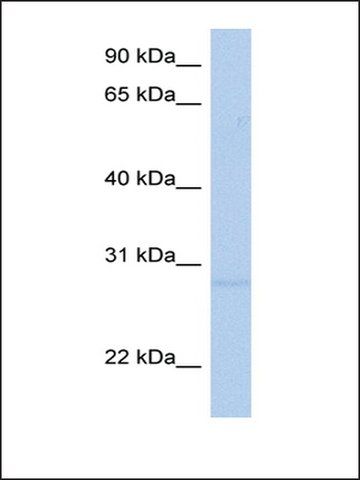 Anti-RNF41 antibody produced in rabbit