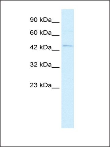 Anti-RNF36 antibody produced in rabbit