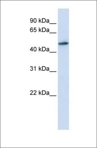 Anti-RNMT antibody produced in rabbit