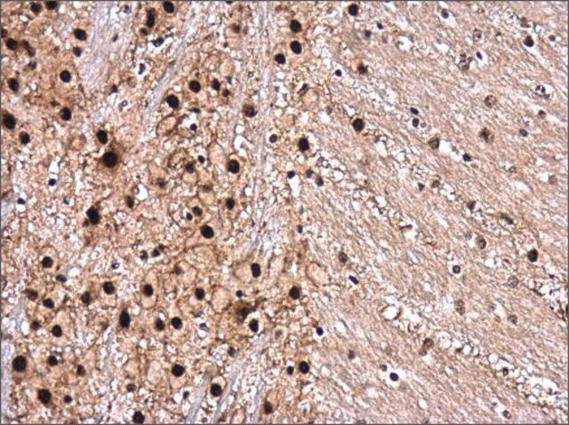 Anti-ROCK2 antibody produced in rabbit