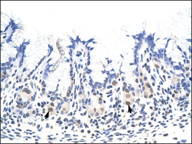 Anti-RP11-78J21.1 (AB2) antibody produced in rabbit