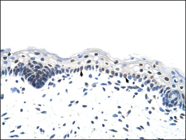 Anti-RP11-78J21.1 (AB1) antibody produced in rabbit