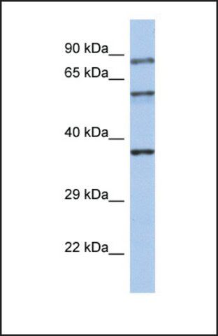 Anti-RPH3A, (N-terminal) antibody produced in rabbit