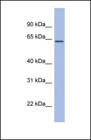 Anti-RPA1 antibody produced in rabbit