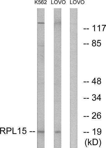 Anti-RPL15 antibody produced in rabbit