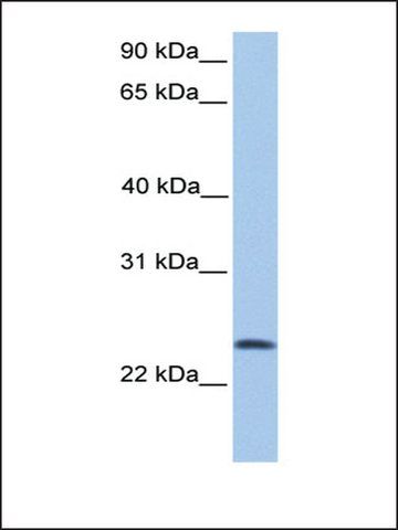 Anti-RP11-269F19.9 antibody produced in rabbit