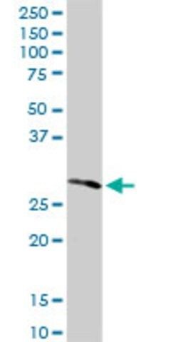 Anti-RPIA antibody produced in rabbit