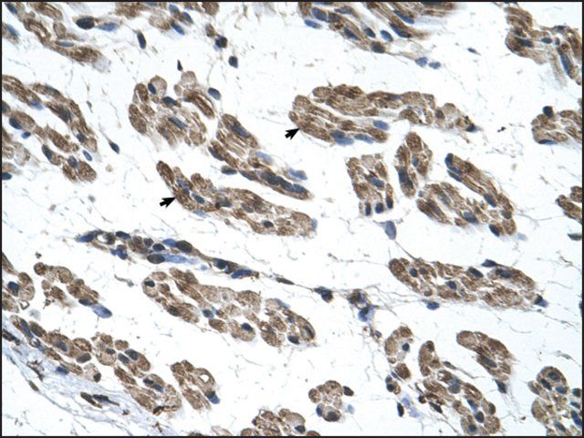 Anti-RNF40 antibody produced in rabbit