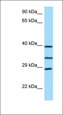 Anti-RP9 antibody produced in rabbit