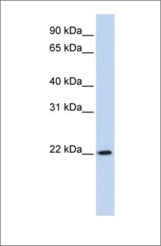 Anti-RP11-529I10.4 (ab1) antibody produced in rabbit