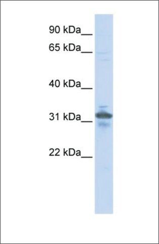 Anti-RPIA antibody produced in rabbit