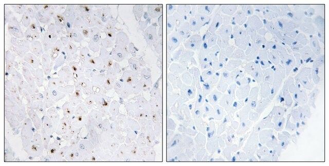 Anti-phospho-Bloom Syndrome (pThr<sup>99</sup>) antibody produced in rabbit