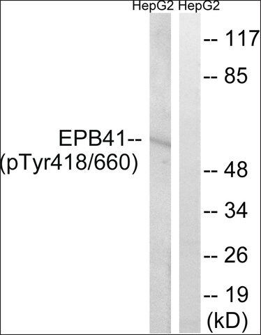 Anti-phospho-EPB41 (pTyr<sup>660/418</sup>) antibody produced in rabbit