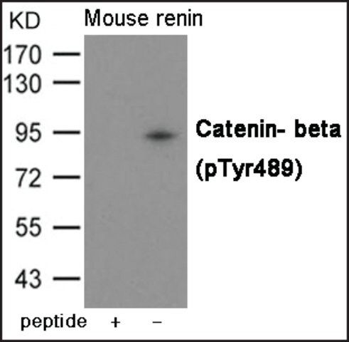 Anti-phospho-Catenin- (pTyr<sup>489</sup>) antibody produced in rabbit