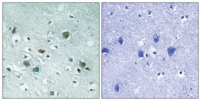 Anti-phospho-CRMP-2 (pThr<sup>509</sup>) antibody produced in rabbit