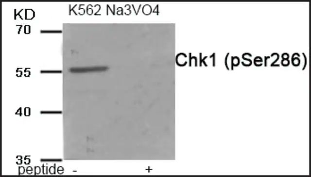 Anti-phospho-Chk1 (pSer<sup>286</sup>) antibody produced in rabbit