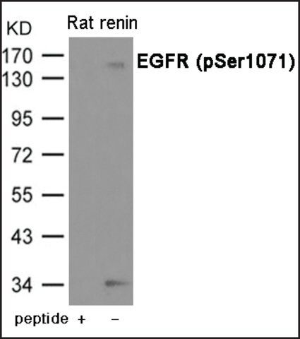 Anti-phospho-EGFR (pSer<sup>1071</sup>) antibody produced in rabbit