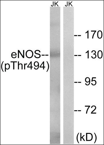 Anti-phospho-eNOS (pThr<sup>494</sup>) antibody produced in rabbit