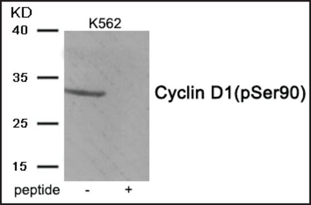 Anti-phospho-Cyclin D1 (pSer<sup>90</sup>) antibody produced in rabbit