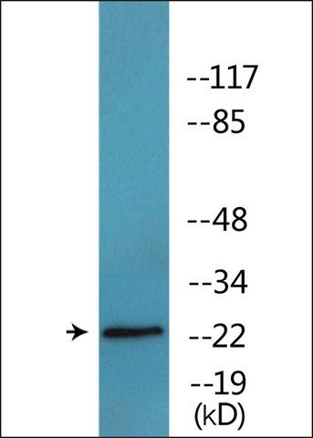 Anti-phospho-Claudin 3 (pTyr<sup>219</sup>) antibody produced in rabbit