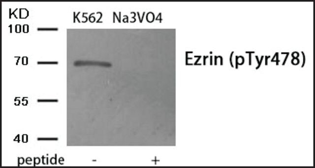 Anti-phospho-Ezrin (pTyr<sup>478</sup>) antibody produced in rabbit