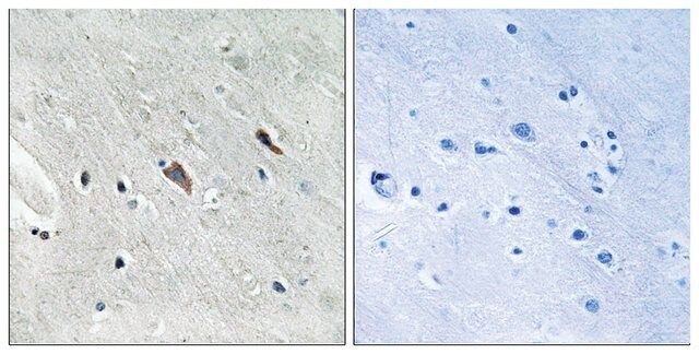 Anti-phospho-Gab2 (pTyr<sup>643</sup>) antibody produced in rabbit