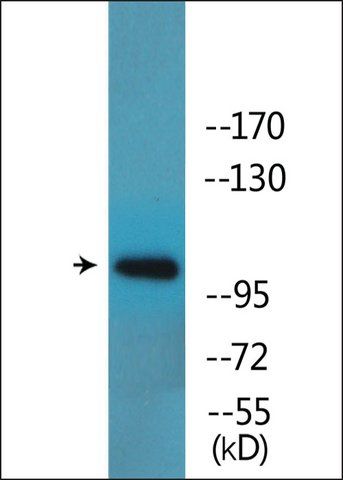 Anti-phospho-GluR1 (pSer<sup>863</sup>) antibody produced in rabbit