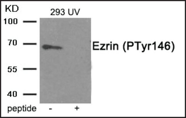 Anti-phospho-Ezrin (pTyr<sup>146</sup>) antibody produced in rabbit