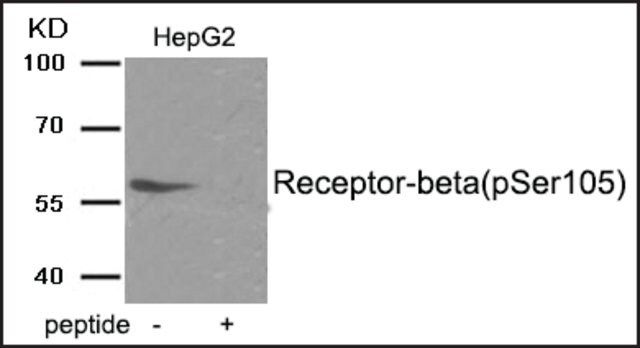 Anti-phospho-Estrogen Receptor- (pSer<sup>105</sup>) antibody produced in rabbit