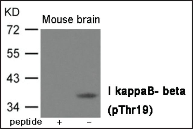 Anti-phospho-IB- (pThr<sup>19</sup>) antibody produced in rabbit