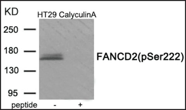 Anti-phospho-FANCD2 (pSer<sup>222</sup>) antibody produced in rabbit