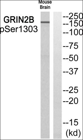 Anti-phospho-GRIN2B (pSer<sup>1303</sup>) antibody produced in rabbit