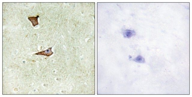 Anti-phospho-IGF2R (pSer<sup>2409</sup>) antibody produced in rabbit