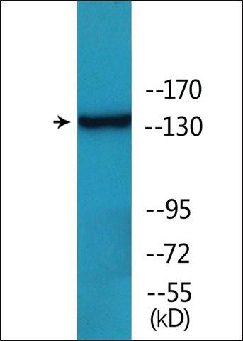 Anti-phospho-HER2 (pTyr<sup>1112</sup>) antibody produced in rabbit