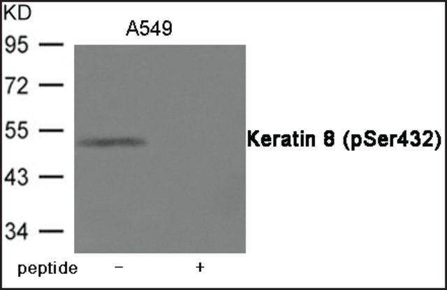 Anti-phospho-Keratin 8 (pSer<sup>432</sup>) antibody produced in rabbit