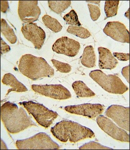 ANTI-PHOSPHO-P27KIP1(S10) antibody produced in rabbit