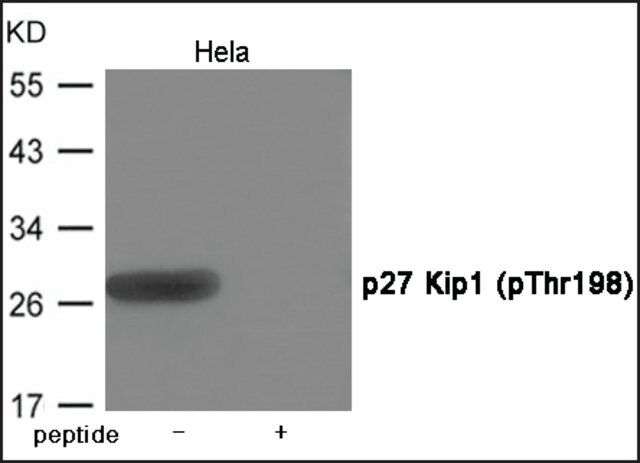 Anti-phospho-p27 Kip1 (pThr<sup>198</sup>) antibody produced in rabbit