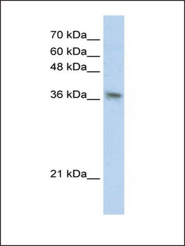 Anti-PHYHIP (AB1) antibody produced in rabbit